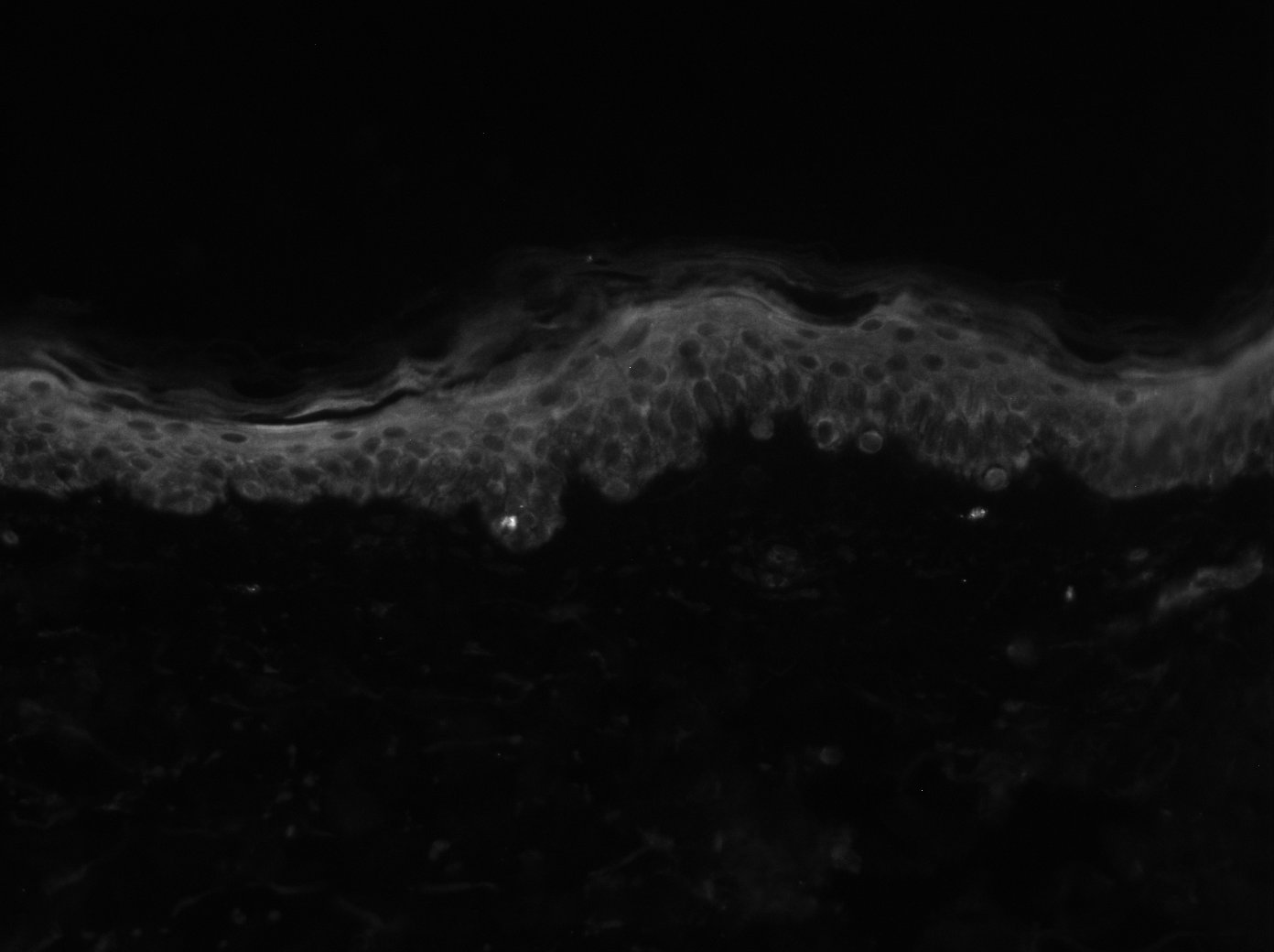 Tight Junction Protein 2 Antibody - BSA Free NBP1-86850