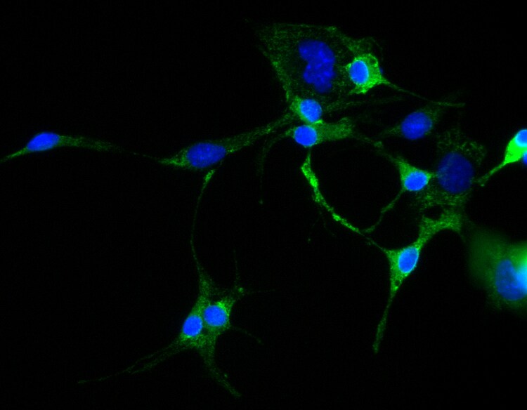 TRP2 Antibody - BSA Free NBP1-86893