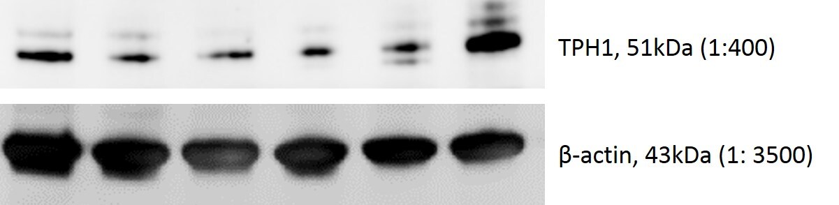 Tryptophan Hydroxylase 1/TPH-1 Antibody - BSA Free NBP1-86922
