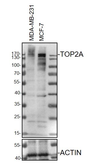 TOP2A Antibody - BSA Free NBP1-86928