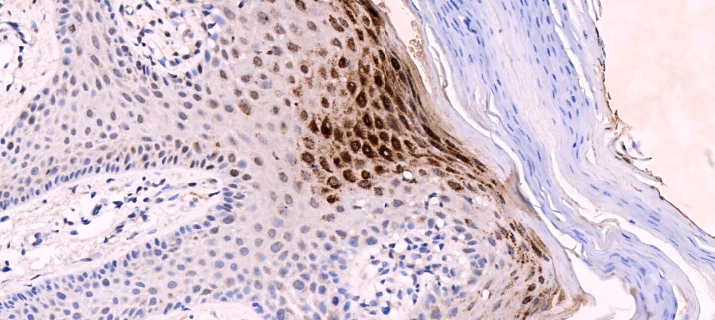 Filaggrin Antibody - BSA Free NBP1-87527