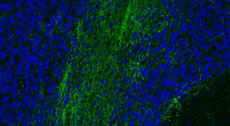 Aquaporin-4 Antibody - BSA Free NBP1-87679