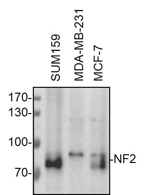 NF2/Merlin Antibody - BSA Free NBP1-87757