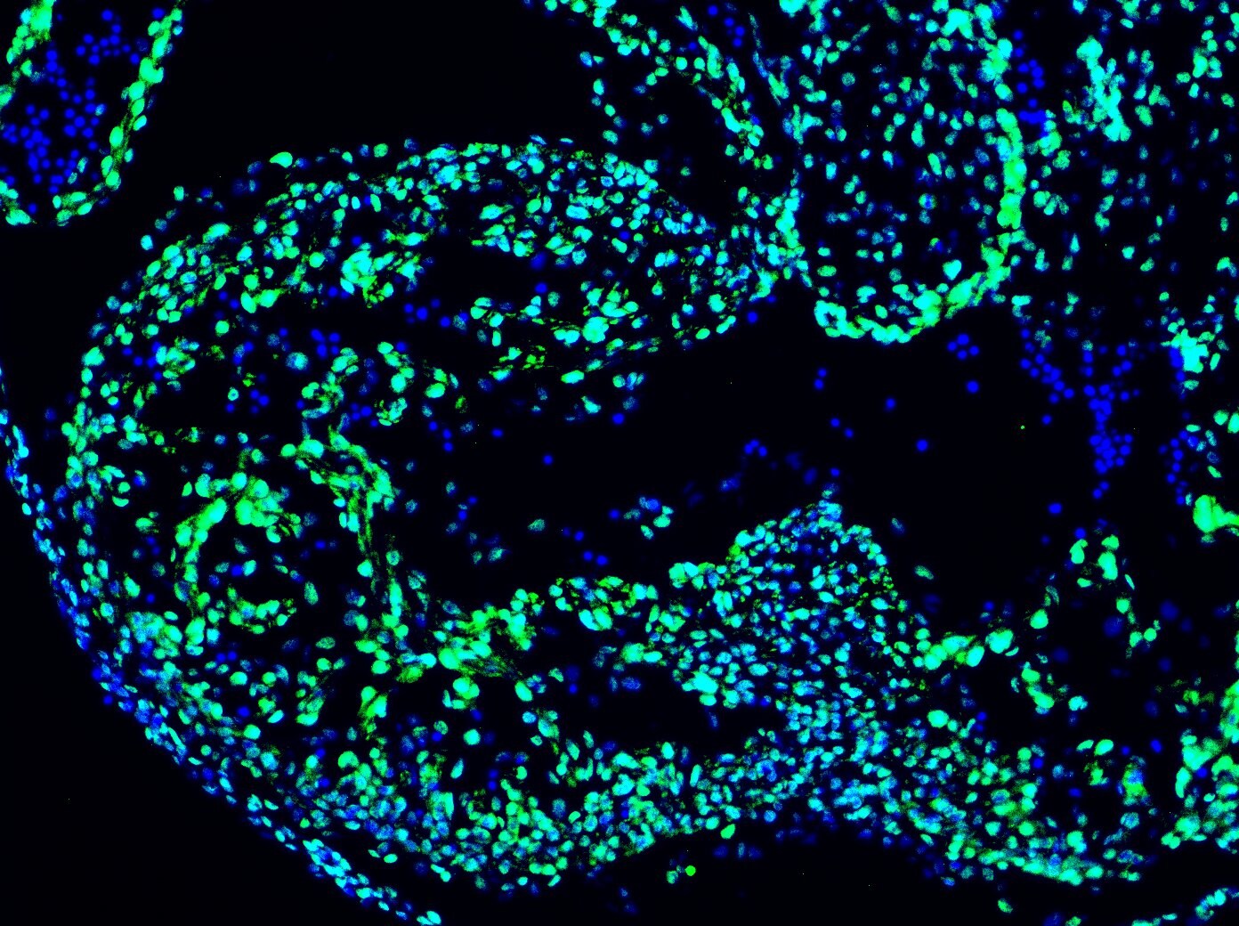 Pea3 Antibody NBP1-87960