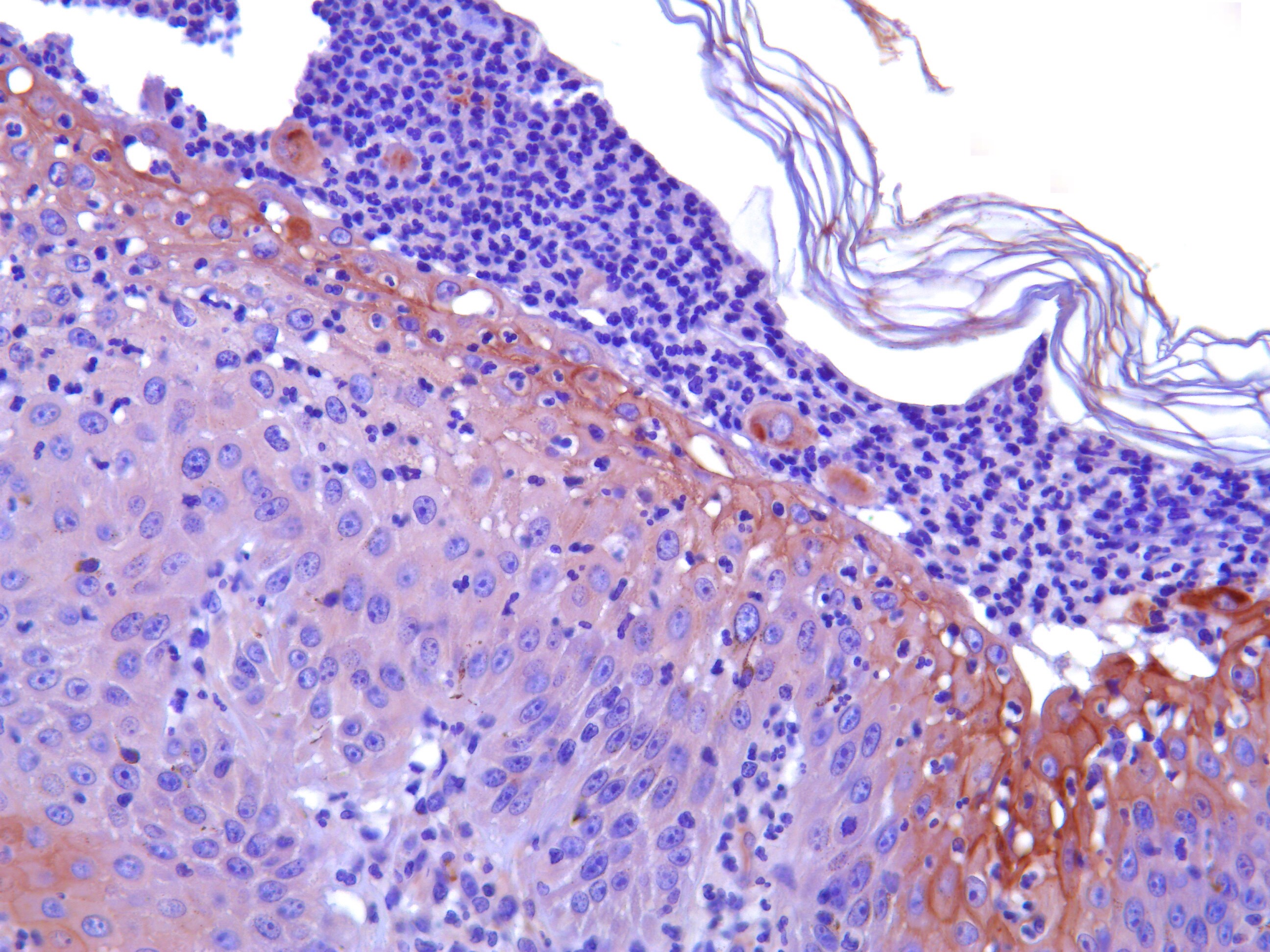 Desmocollin-1 Antibody - BSA Free NBP1-88099