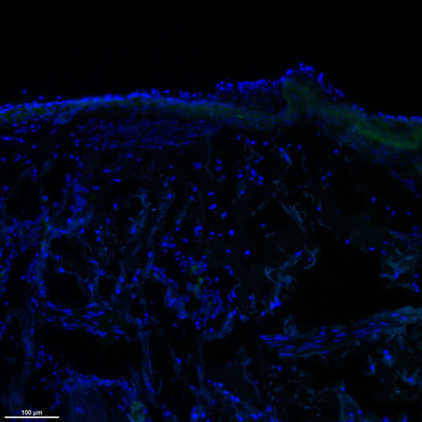Syndecan-1/CD138 Antibody - BSA Free NBP1-88135