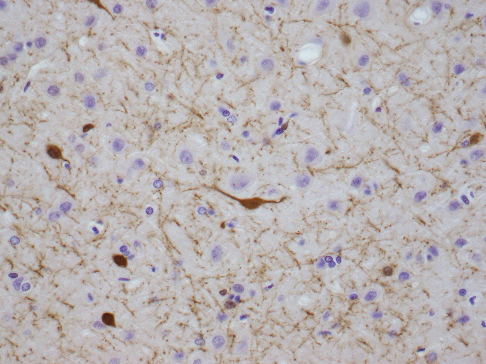 Calretinin Antibody - BSA Free NBP1-88220