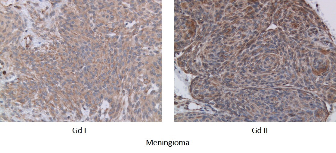 DTX3L Antibody - BSA Free NBP1-88699