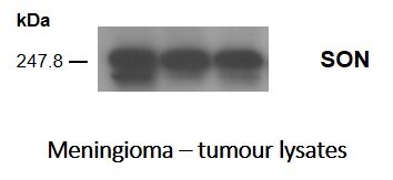 SON Antibody - BSA Free NBP1-88706