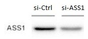 Argininosuccinate Synthase Antibody - BSA Free NBP1-88868