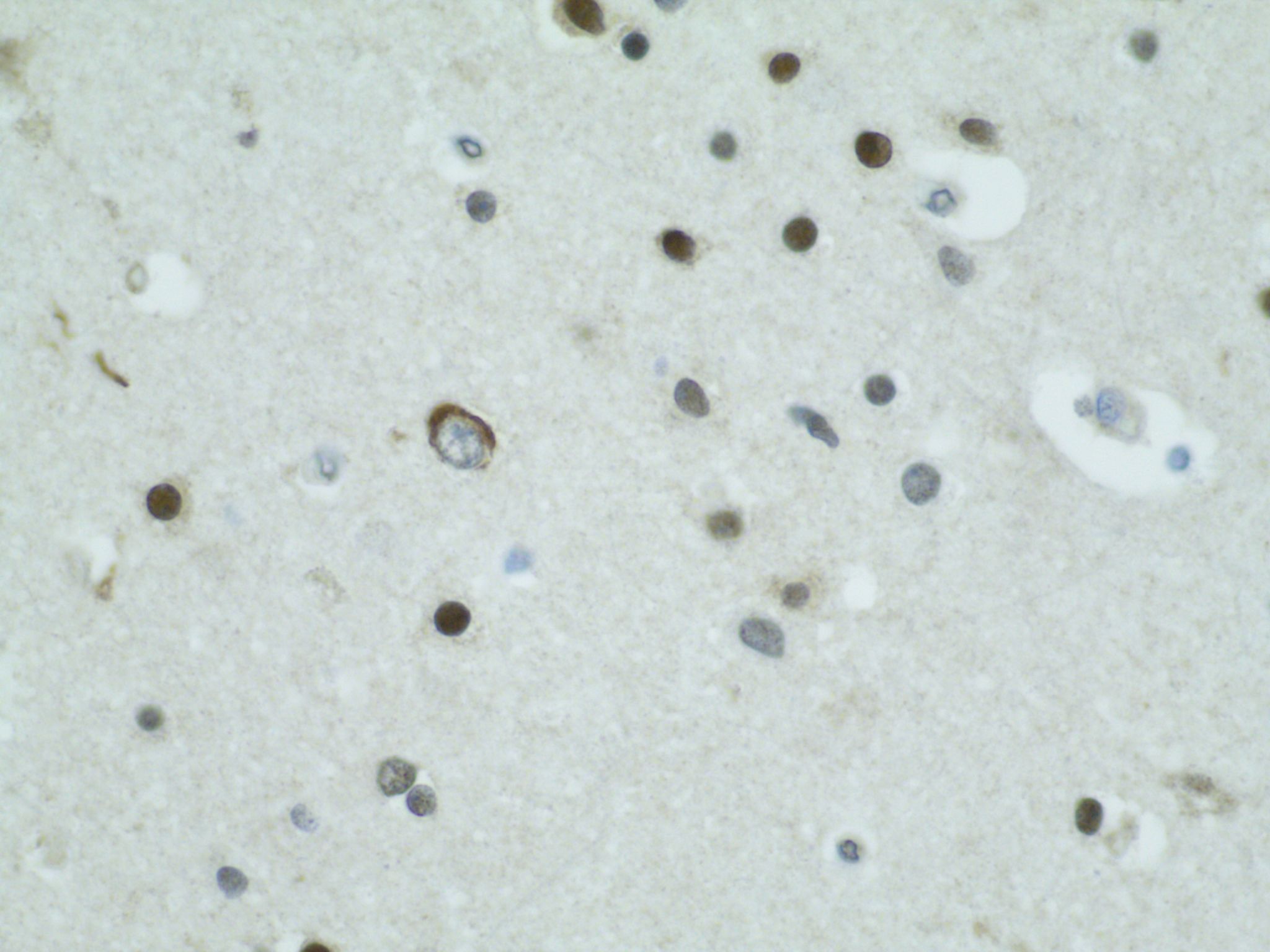 FUS Antibody - BSA Free NBP1-89113