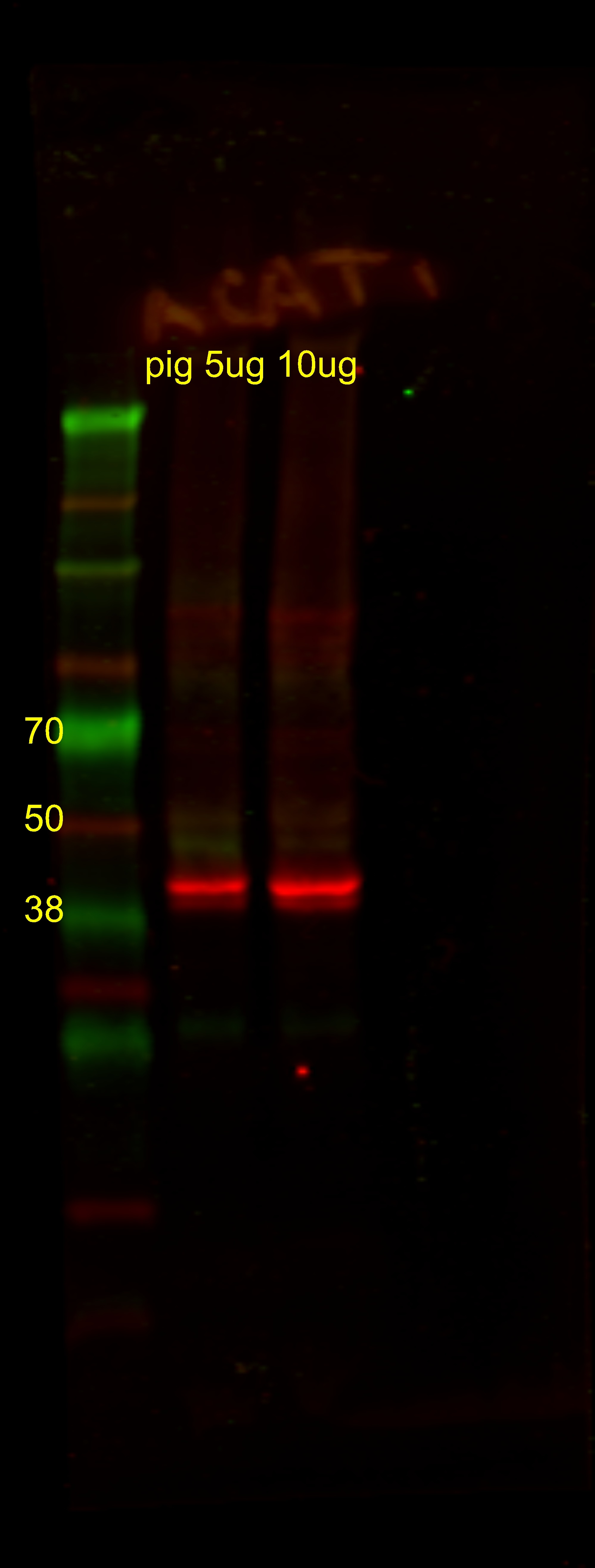ACAT1 Antibody - BSA Free NBP1-89284