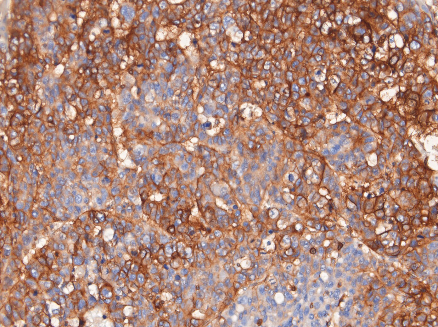 SLC1A5 Antibody - BSA Free NBP1-89327