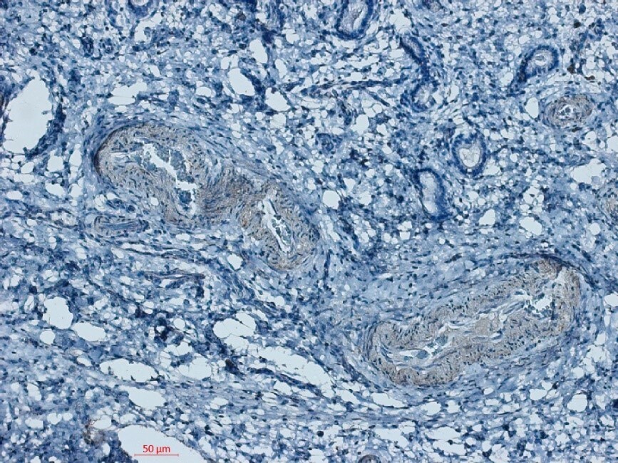 VAP-1/AOC3 Antibody - BSA Free NBP1-89671