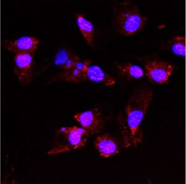 TAO Kinase 1 Antibody - BSA Free NBP1-89864