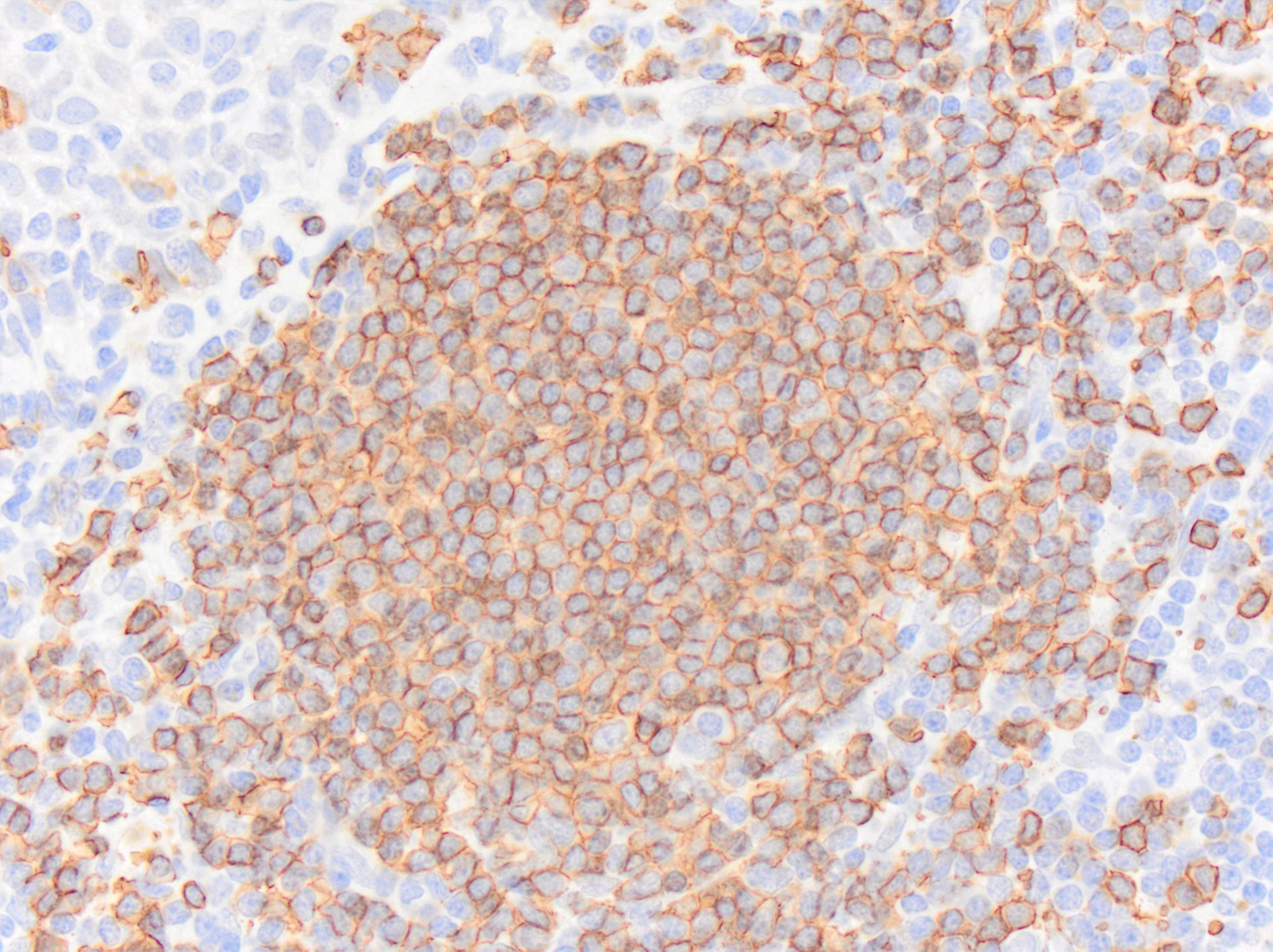 CD20 Antibody - BSA Free NBP1-90051