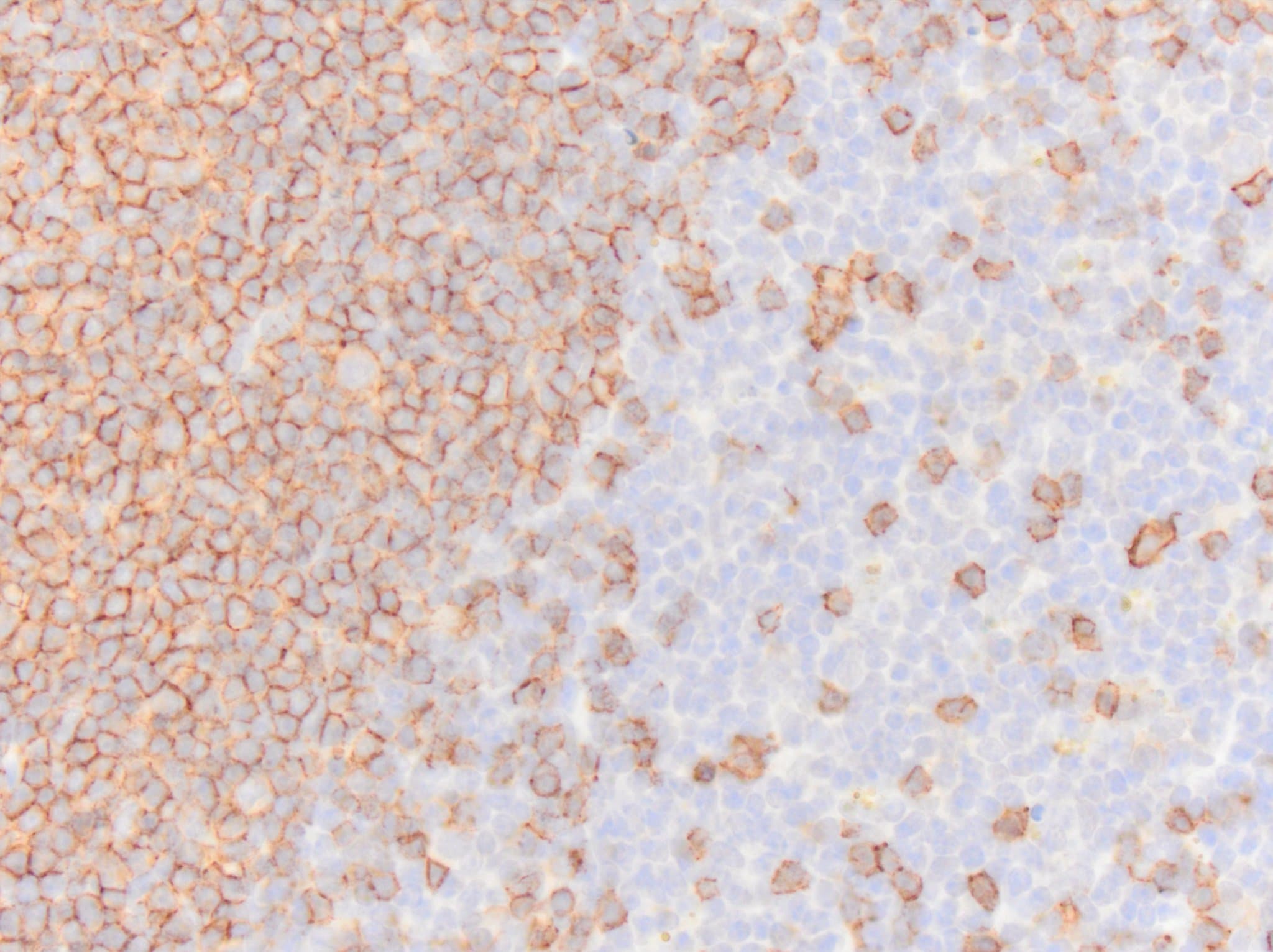 CD20 Antibody - BSA Free NBP1-90051