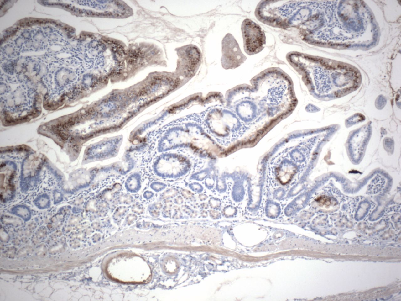 Annexin A10 Antibody - BSA Free NBP1-90156