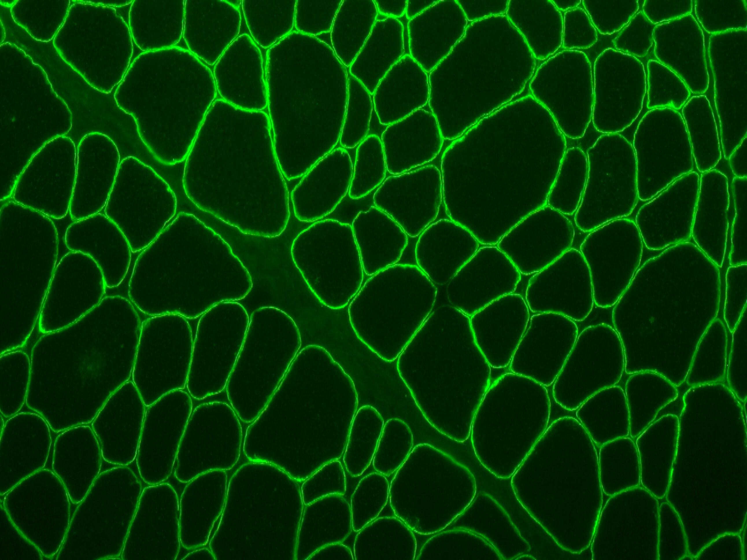 gamma Sarcoglycan Antibody - BSA Free NBP1-90299