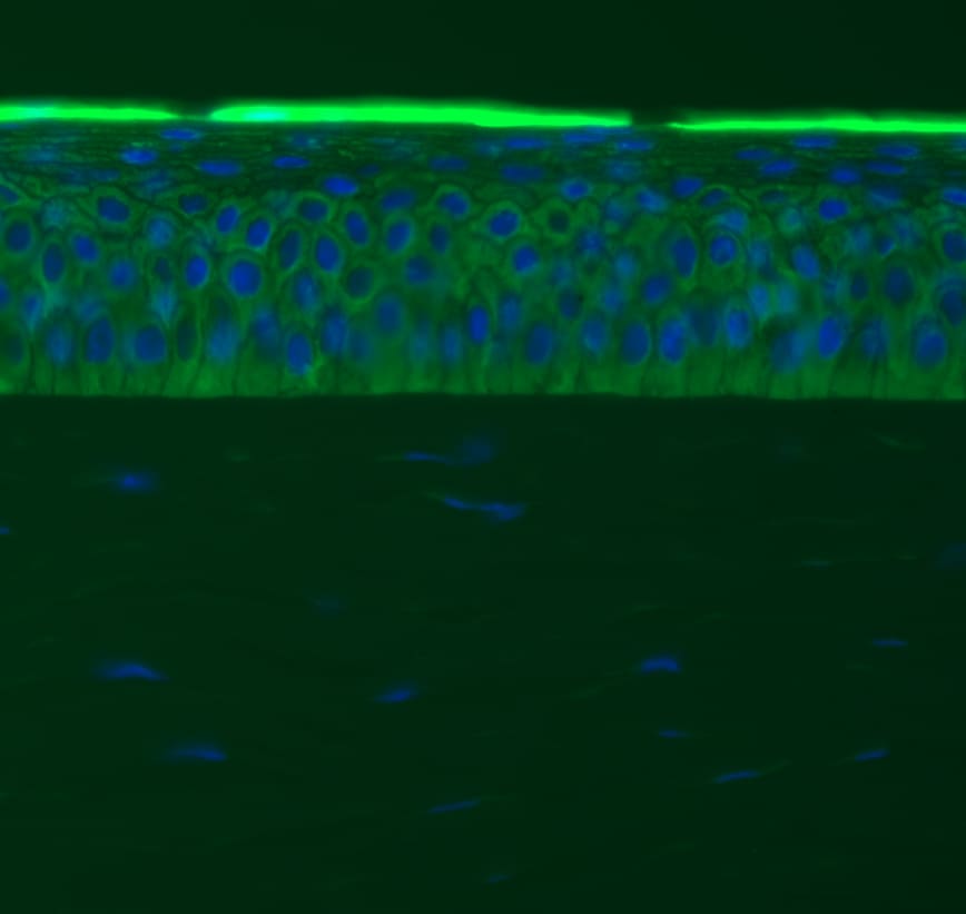 Fibronectin Antibody - BSA Free NBP1-91258