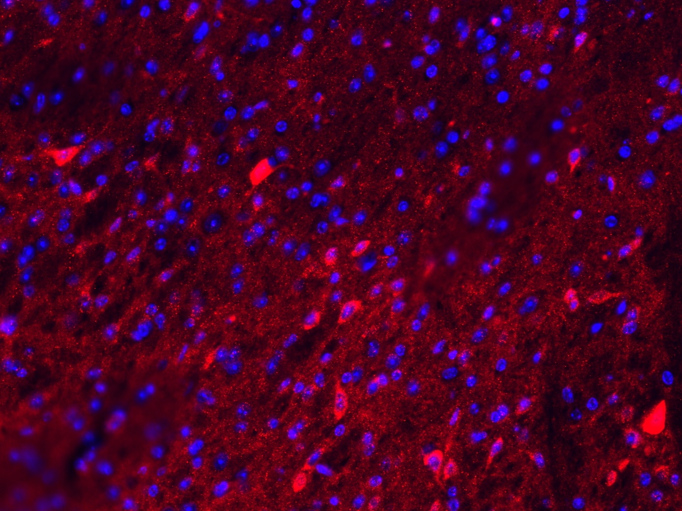 Fibronectin Antibody - BSA Free NBP1-91258