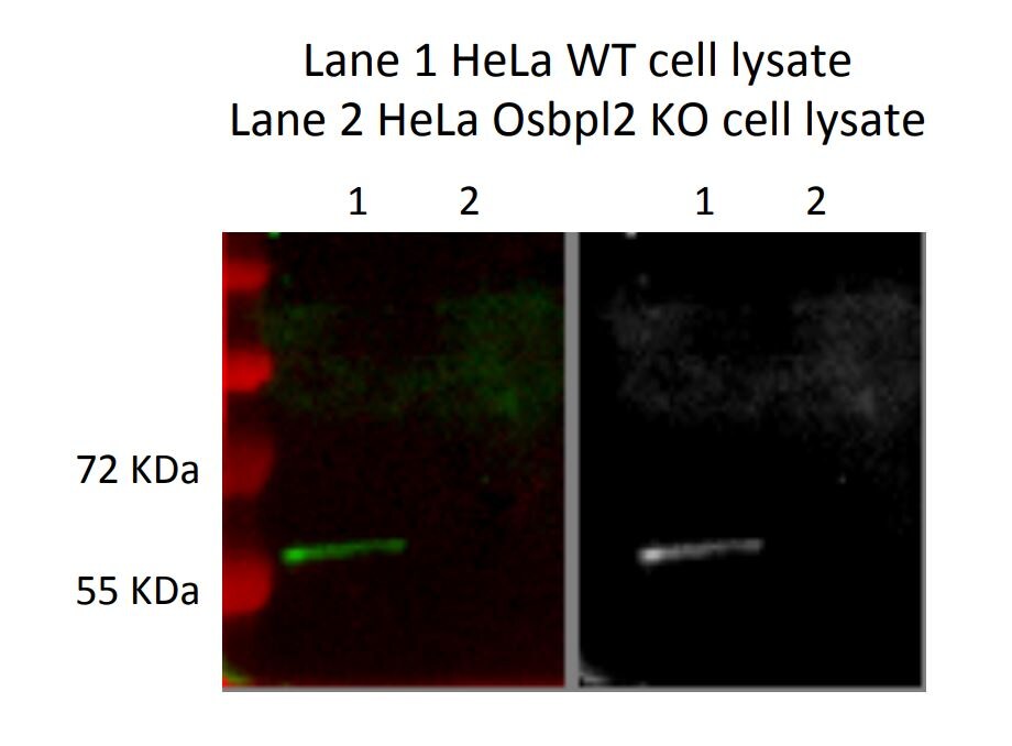 OSBPL2 Antibody - BSA Free NBP1-92236
