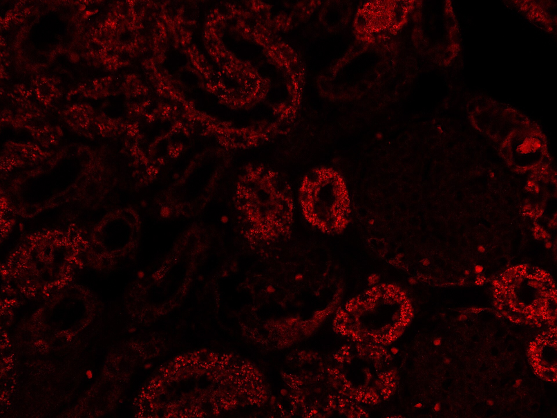 SGLT2/SLC5A2 Antibody - BSA Free NBP1-92384