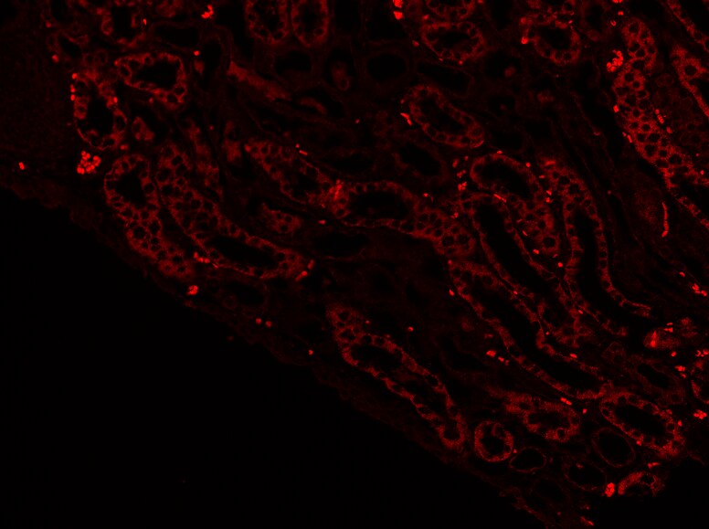 SGLT2/SLC5A2 Antibody - BSA Free NBP1-92384