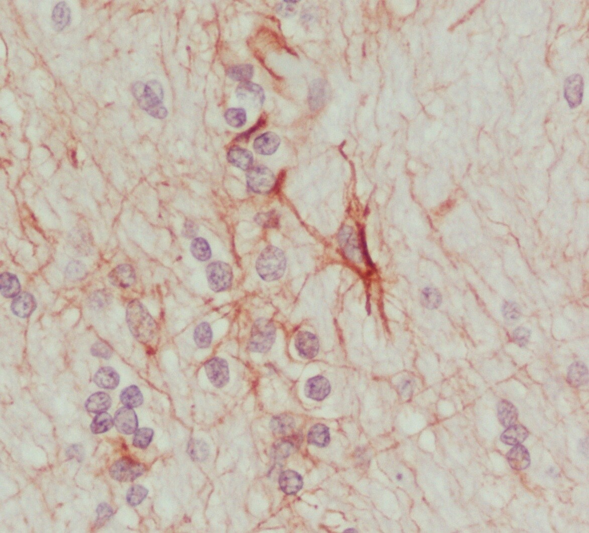 Synaptotagmin 13 Antibody - BSA Free NBP1-92466