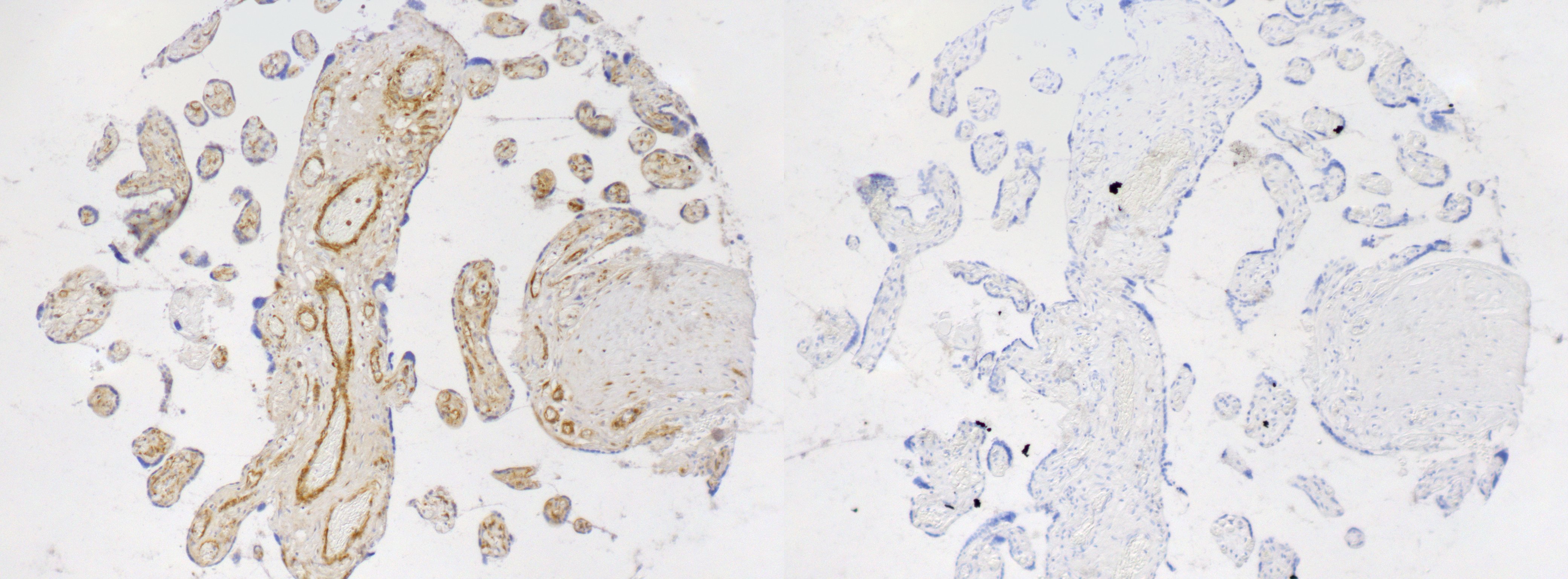 Uroplakin IIIB Antibody - BSA Free NBP1-92564