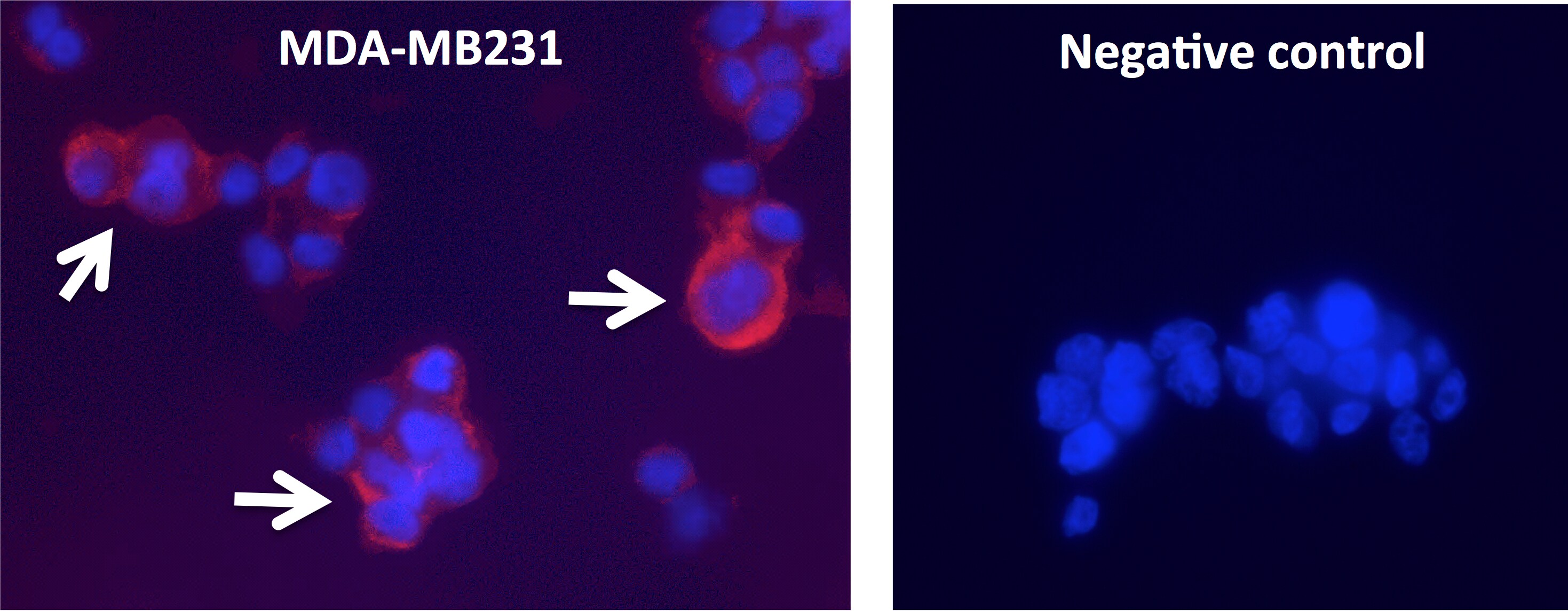 Galectin-3 Antibody (5C21) - BSA Free NBP1-92690