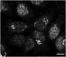 TMEM87B Antibody - BSA Free NBP1-94006
