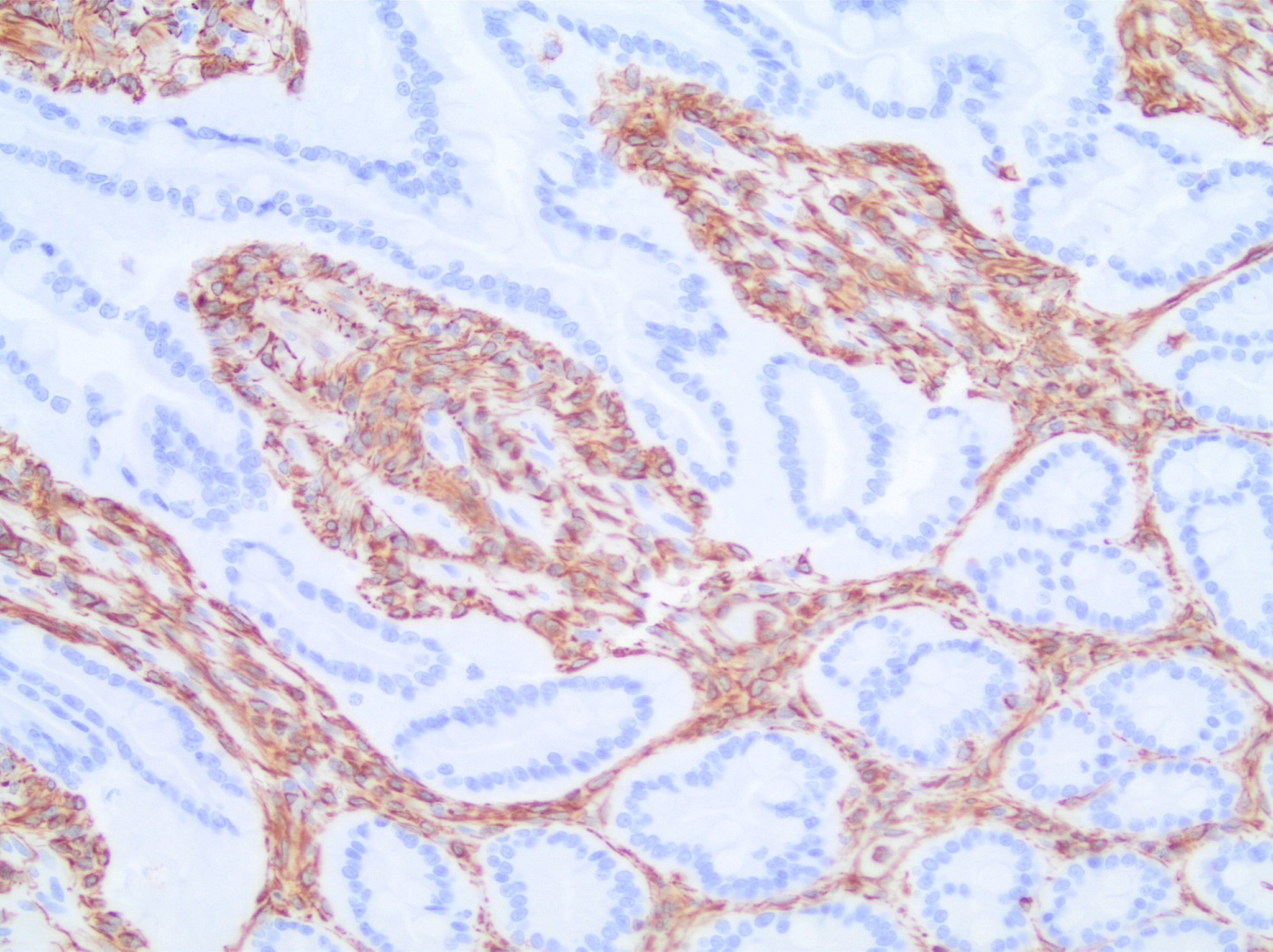 Vimentin Antibody (V9) - BSA Free NBP1-97670