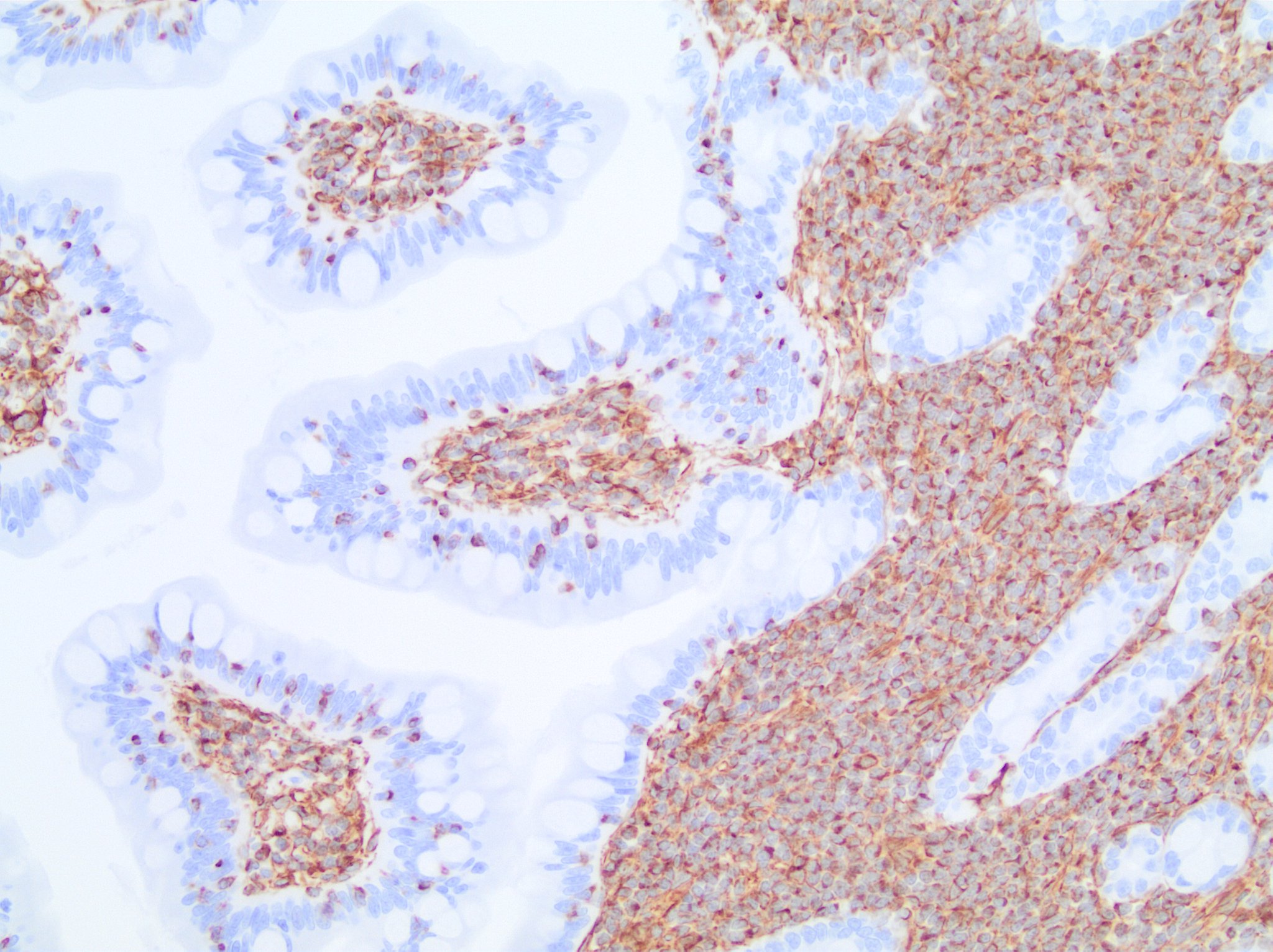 Vimentin Antibody (V9) - BSA Free NBP1-97670