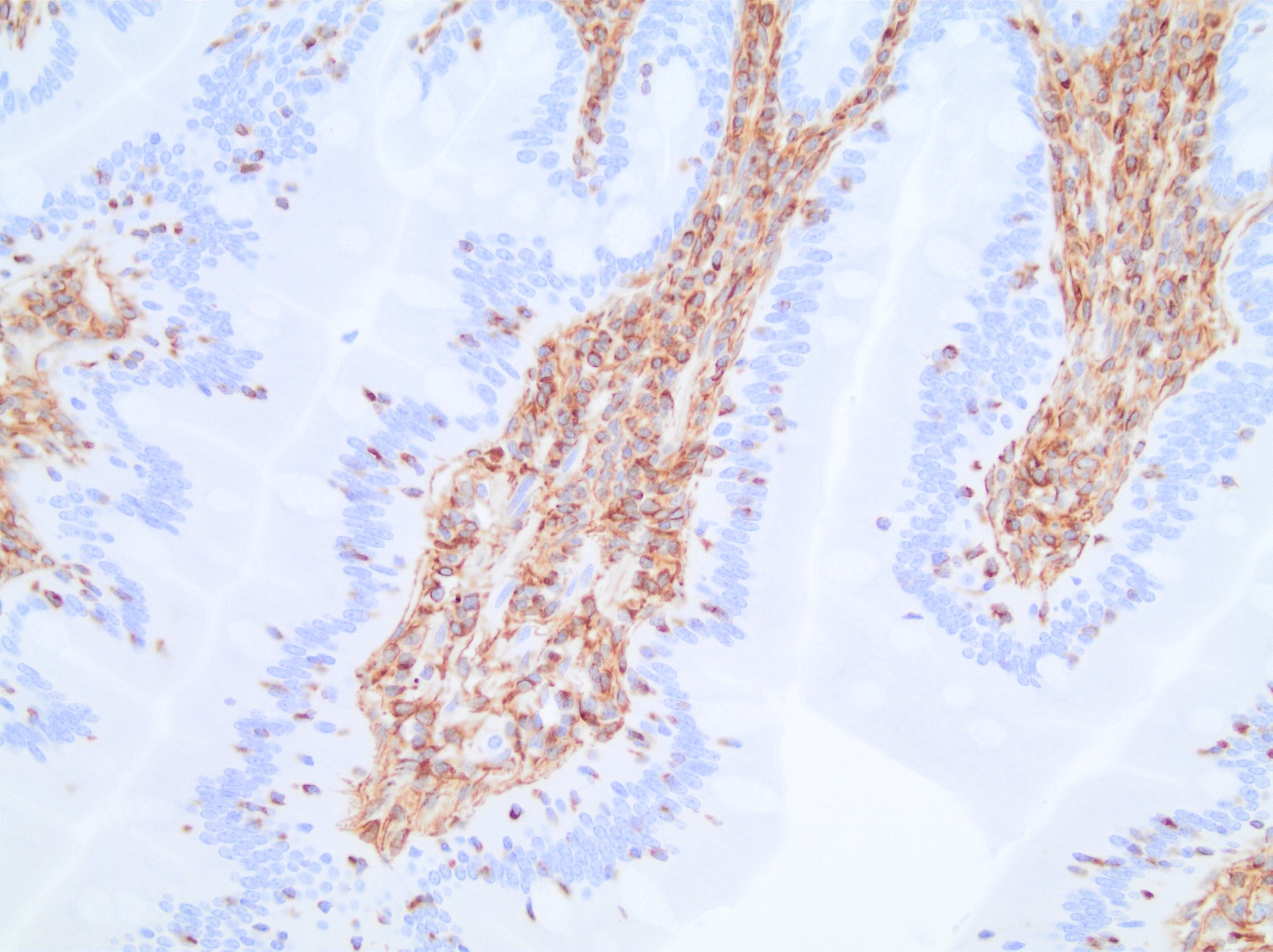 Vimentin Antibody (V9) - BSA Free NBP1-97670