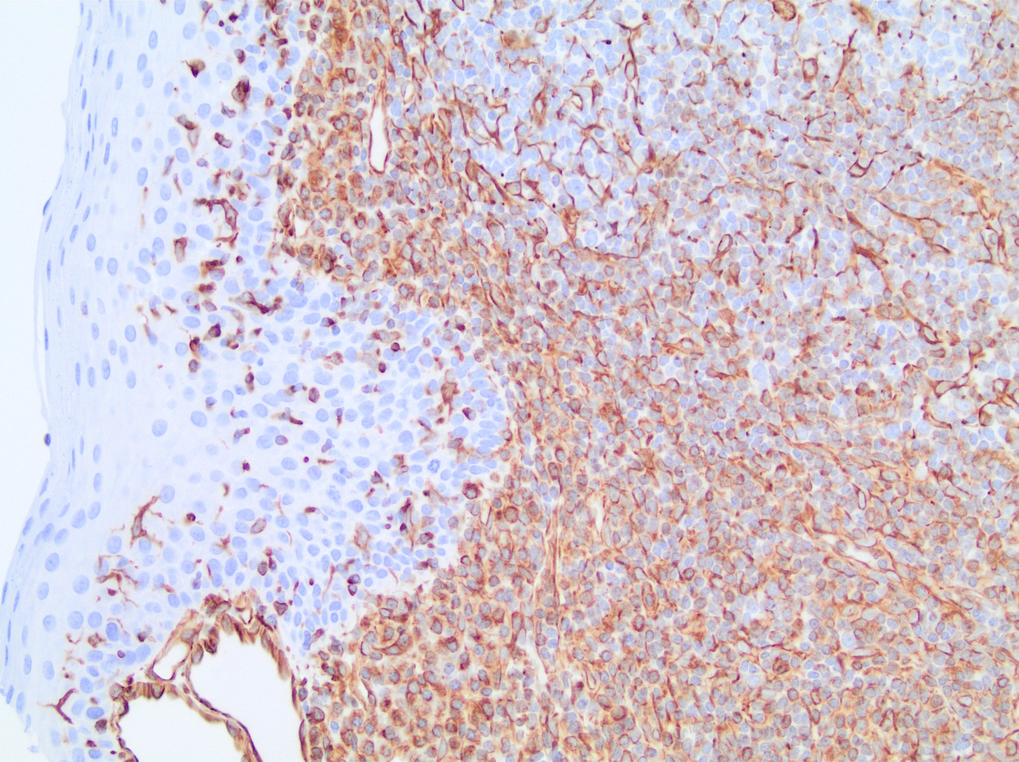 Vimentin Antibody (V9) - BSA Free NBP1-97670
