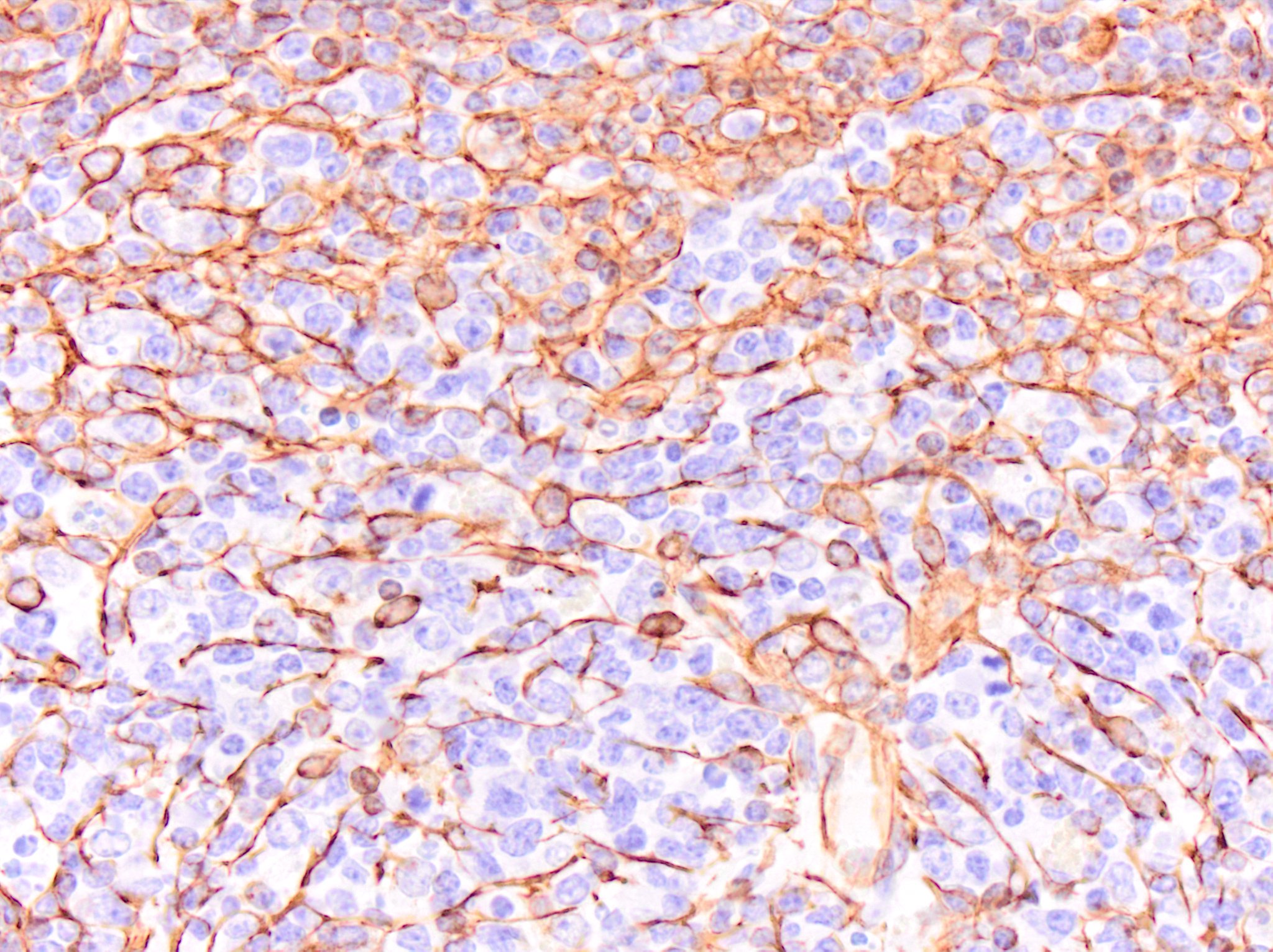 Vimentin Antibody (V9) - BSA Free NBP1-97670
