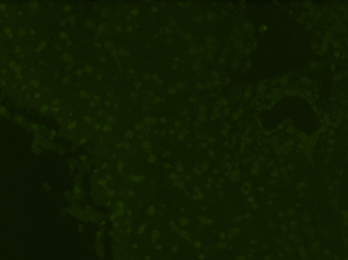 Vimentin Antibody (RV202) [FITC] NBP1-97672F