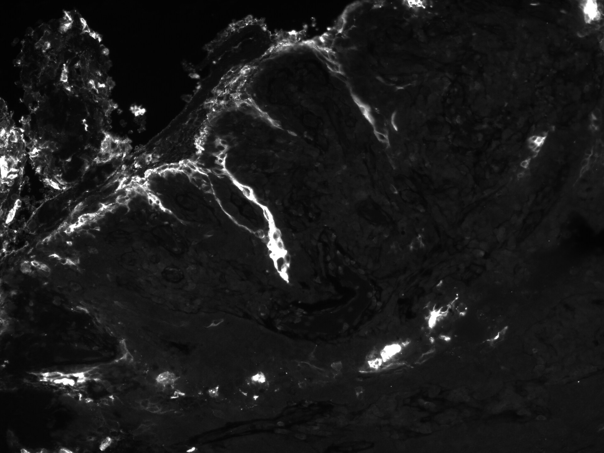 CEA Antibody (PARLAM 4) - BSA Free NBP1-97718