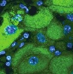 Catalase Antibody (OTI1B8) NBP2-00492