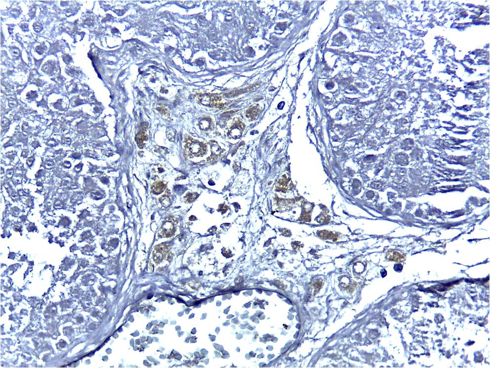 Cytochrome P450 17A1 Antibody (OTI3F11) NBP2-01151
