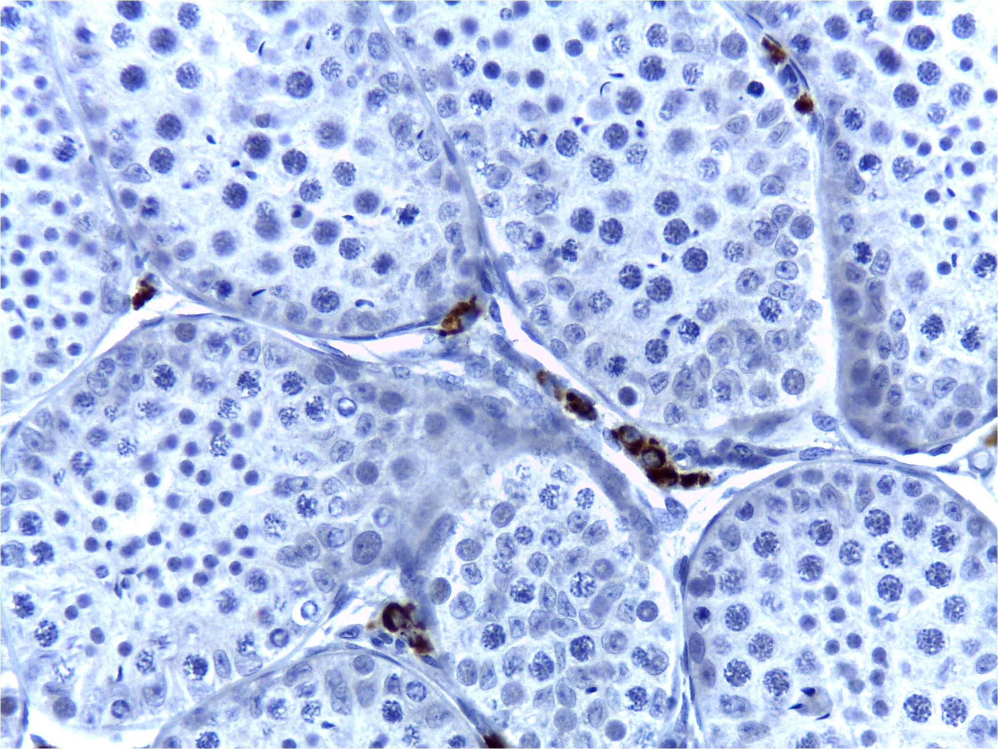 Cytochrome P450 17A1 Antibody (OTI3F11) NBP2-01151