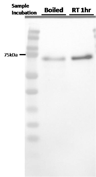 Ribophorin I Antibody (OTI3H3) NBP2-01294