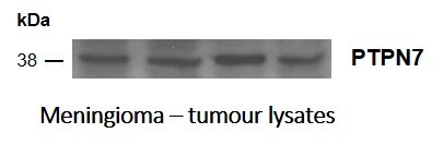 PTPN7 Antibody (OTI3B10) NBP2-01340