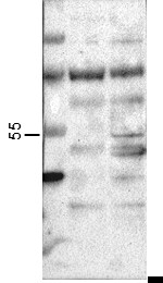 ASCC1 Antibody (OTI6G5) NBP2-01345
