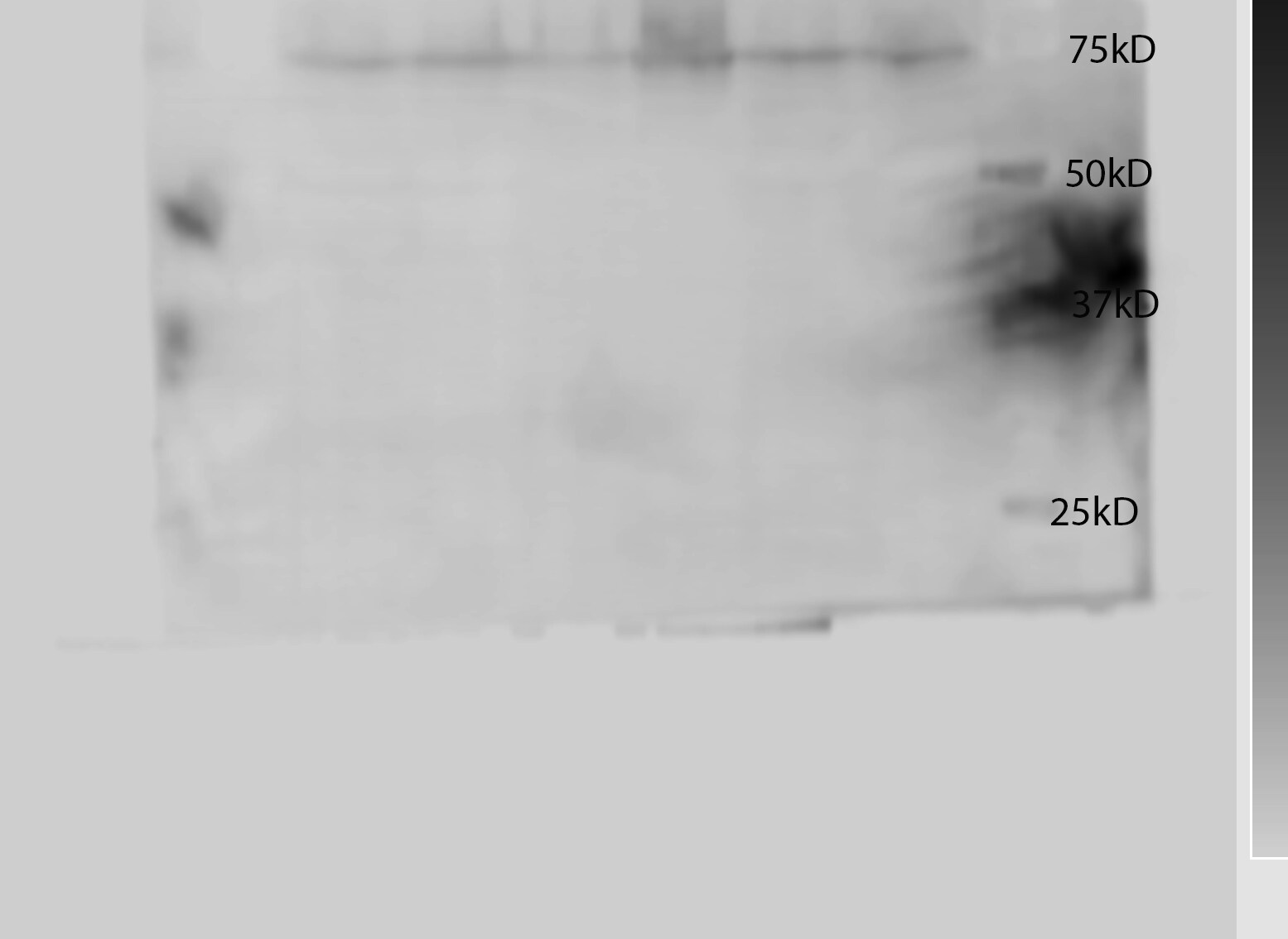 FMRP Antibody (OTI1C6) NBP2-01770