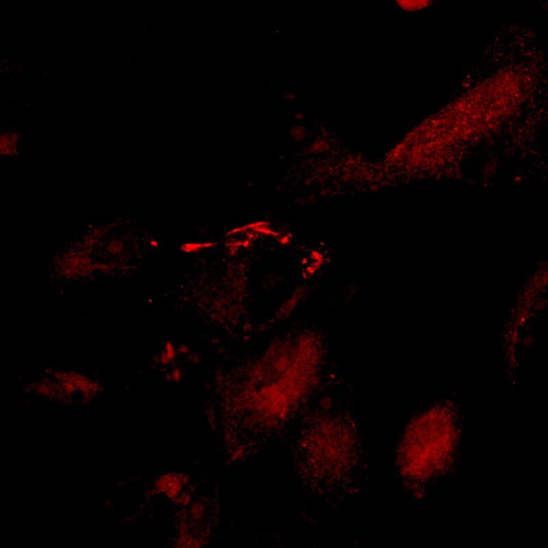 Claudin-5 Antibody (OTI1G4) NBP2-02259