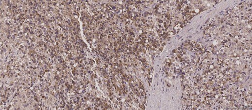 HIBCH Antibody (OTI3H5) NBP2-02673