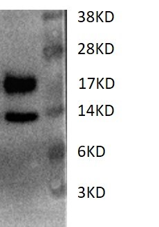 Cystatin E/M/CST6 Antibody (RM0217-6F49) [Biotin] NBP2-12252B