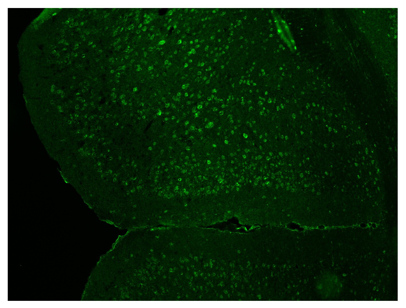 Insulin Receptor beta Antibody - BSA Free NBP2-12793